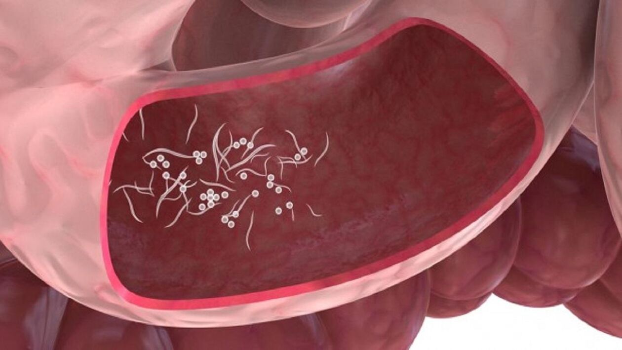 Giardia-parasieten in de lever