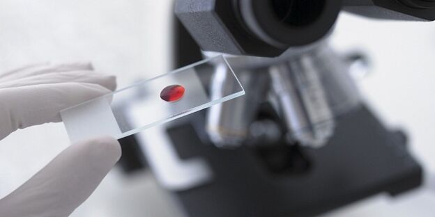 bloedonderzoek om parasieten in het lichaam te diagnosticeren