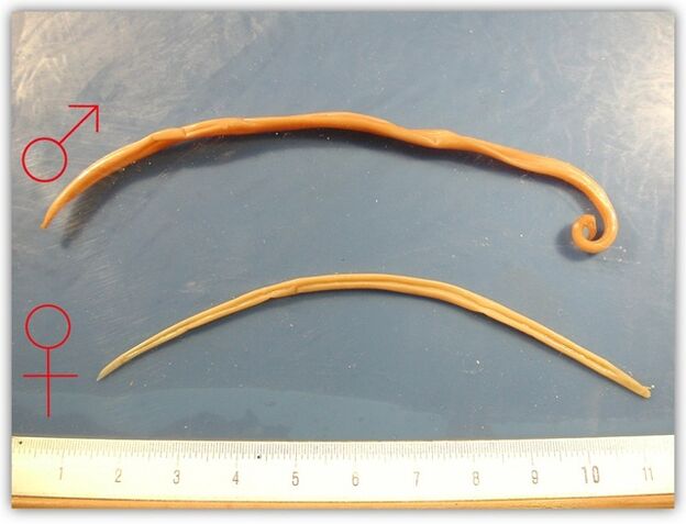 hoe rondwormen eruit zien