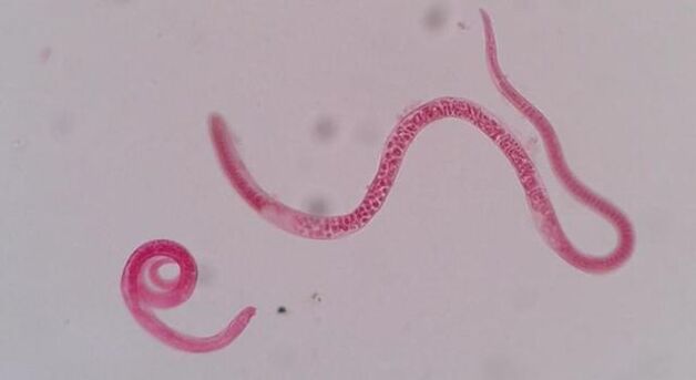 hoe zien trichinella eruit